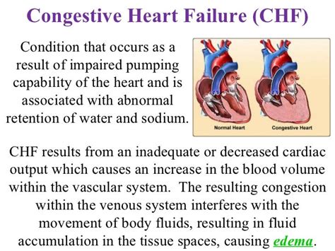 Congestive Heart Failure Picture Congestive Heart Failure Chf