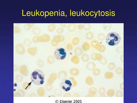 Ppt Leukopenia Leukocytosis Powerpoint Presentation Id425635