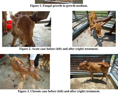 Table 1 From Dermatophytosis Ringworm And Its Treatment Approaches In