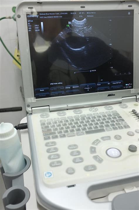 Cardiac Ultrasound Tech Salary Nj Neat Online Journal Pictures Library