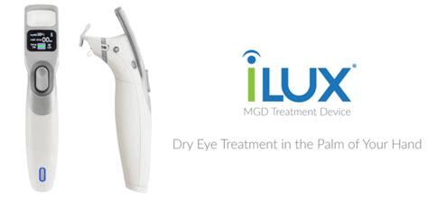 What To Expect From Ilux Dry Eye Treatment