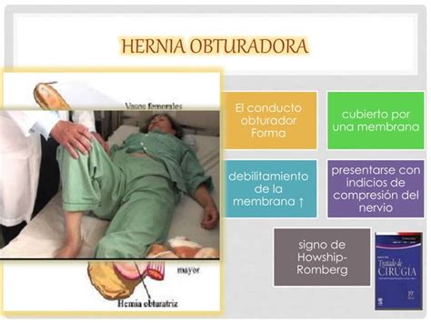 Hernias Pared Abdominal Anterolateral Y Lumbar Ppt