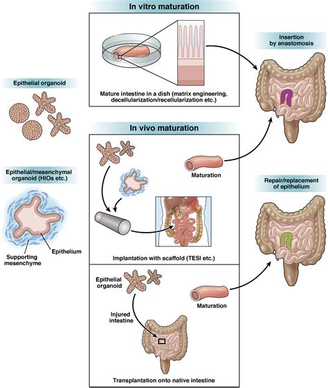 Advancing Intestinal Organoid Technology Toward Regenerative Medicine