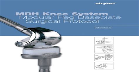 Mrh Knee System Modular Peg Baseplate Surgical Total Knee Instruments 1