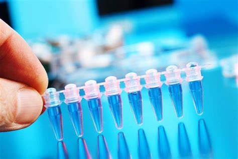 Quanto Custa Exame De Dna Com Fio De Cabelo