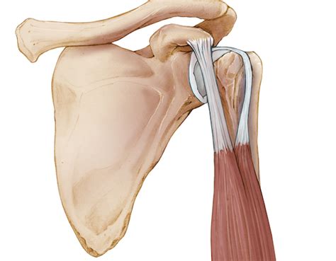 Biceps Tendon Rupture