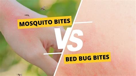 Bed Bug Bites Vs Mosquito Bites What S The Difference Bug Repellent Bracelet