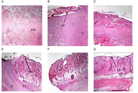 These aberrations can be grouped into three general categories: Histological changes during the wound-healing process ...