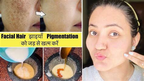 In 7 Days 💕remove झाइयाँ Blemishes Pigmentation Facial Naturally