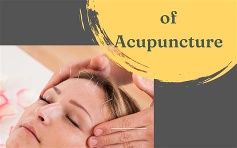 Mental Benefits Of Acupuncture Sf Custom Chiropractic