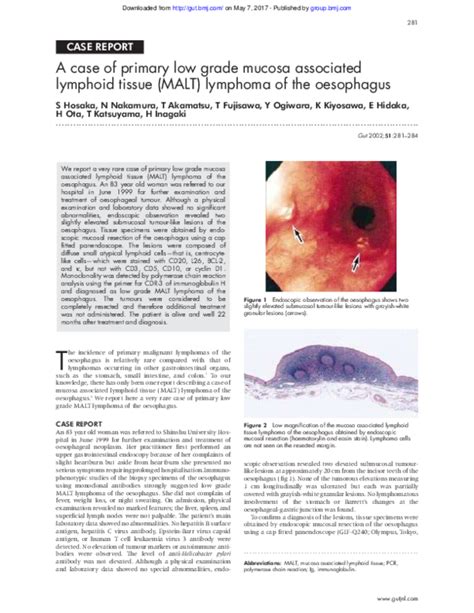Pdf A Case Of Primary Low Grade Mucosa Associated Lymphoid Tissue