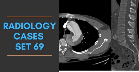 Body Imaging Radiology Cases Spotter Set 71 Radiogyan