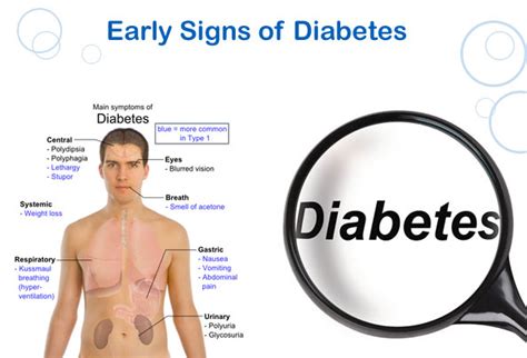 Type 2 Diabetes Symptoms and Signs - Health Normal