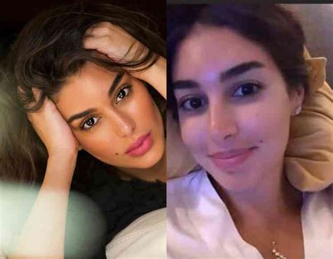 يحاول طبيب الأسنان علاج السن عادةً قبل اللجوء إلى خلعه، بسبب المشاكل التي يسببها الخلع جمالياً وصحياً للثة والأسنان. ياسمين صبري قبل وبعد / ÙŠÙ…Ù† Ø¯Ø§ÙŠØ±ÙƒØª ØªØ³Ø±ÙŠØ ...