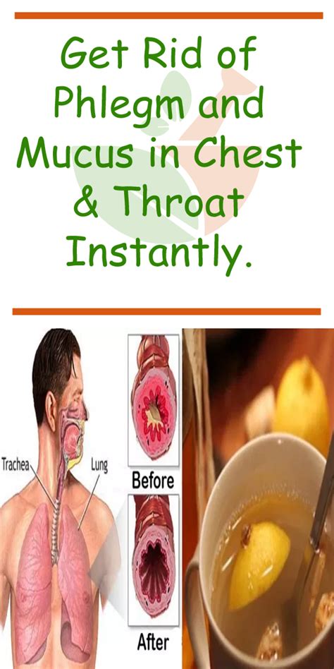 Get Rid Of Phlegm And Mucus In Chest And Throat Instantly Chest Throat