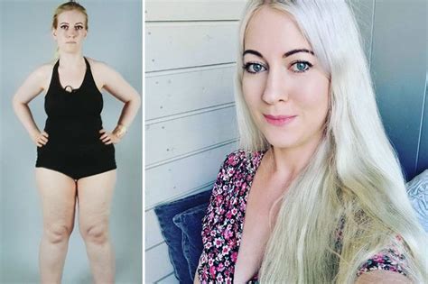 woman born with male and female genitals crowdfunds for op after docs stitch up vagina daily