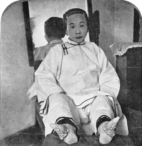 Woman With Bound Feet Illustration World History Encyclopedia