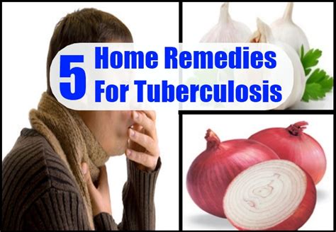 Tuberculosis Home Remedies Natural Treatments And Cure