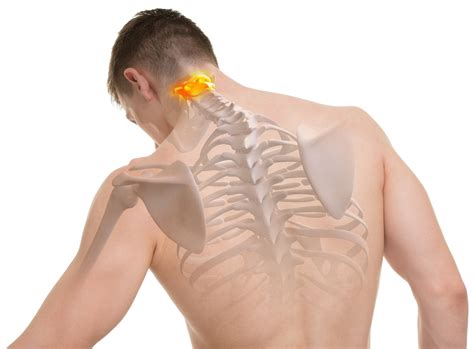 Get The Lowdown On C1 And C2 Spinal Cord Injuries
