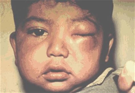 Documentexpert a lansat căutarea stadiului la dosar online in baza ordinelor de reodbandire a. Pediatria practica. Enfermedad de Chagas. La importancia ...