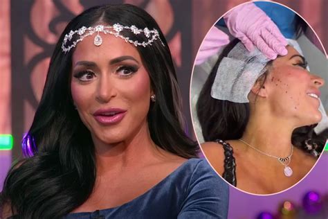 Jersey Shore’s Angelina Pivarnick Shocks Fans With Graphic Facelift Video Watch Perez Hilton