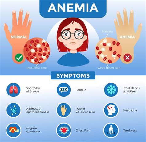 Anemia Hands
