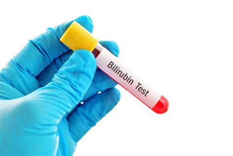 What Do High And Low Bilirubin Levels Mean Health And Detox And Vitamins