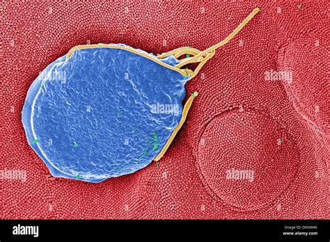 This Digitally Colorized Scanning Electron Micrograph SEM Depicted