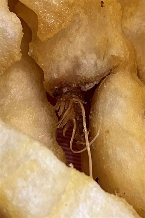 Clump Of Ingrown Hairs Sorry About My Dry Skin Nudes Popping NUDE