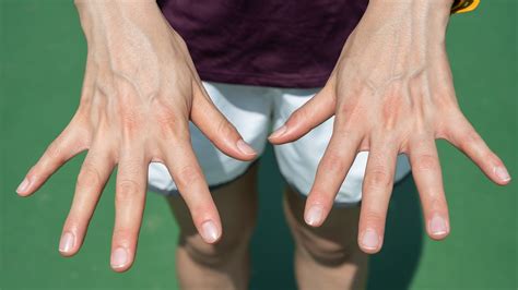 Doctors Explain What Veiny Hands Reveal About Your Health Power Of