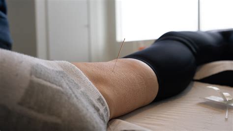 Acupuncture For Diabetes Perfect Balance Clinic
