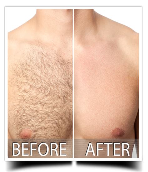 Skin Doctor for Laser treatment | hair removal | discoloration | wrinkle problems and treatment ...