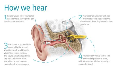 FAQ S About Hearing Loss Whisper Audiology