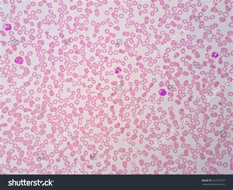 Human Blood Cells Under Microscope View Stock Photo 561202210