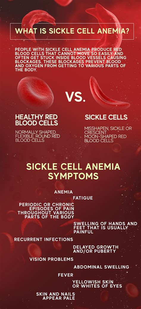Sickle Cell Anemia Cause Symptoms And Treatment 2023