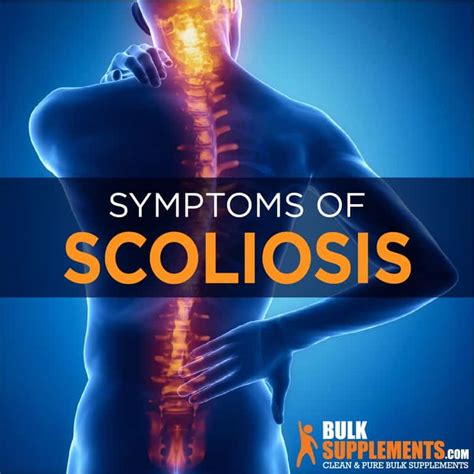 Scoliosis Symptoms Causes And Treatment