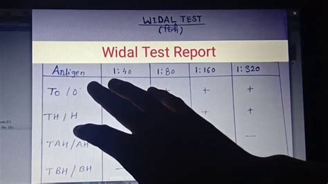 The result is the report you're reading now: Widal Test | How To Read Widal Test Report (Enteric Fever ...