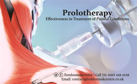 Prolotherapy Treatment London Musculoskeletal Centre Orthopedic And Sports Medicine