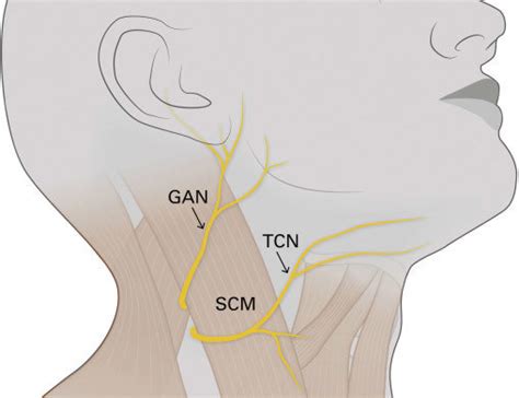 Illustration Showing The Courses Of The Great Auricular Nerve Gan And