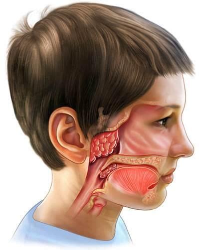 33 Best Images About Adenoides On Pinterest