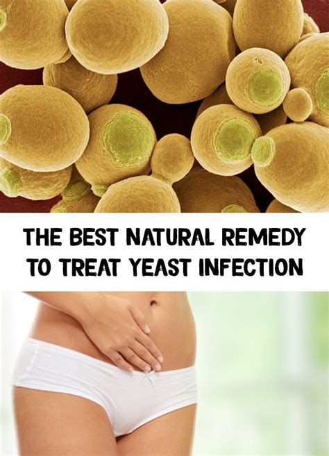 Genital Itching Or Burning Might Indicate You Have A Yeast Infection