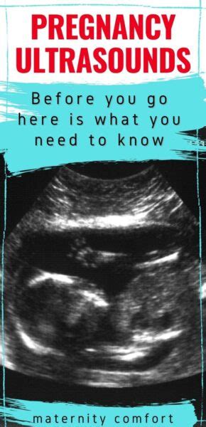 What Every Pregnant Woman Should Know About Screening Ultrasounds
