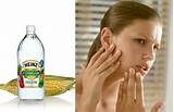 Pictures of Pimples Home Remedies For Dry Skin