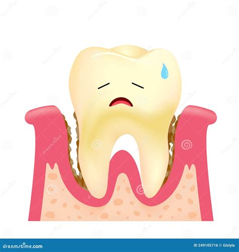 Cute Cartoon Tooth Character With Gums Stock Vector Illustration Of