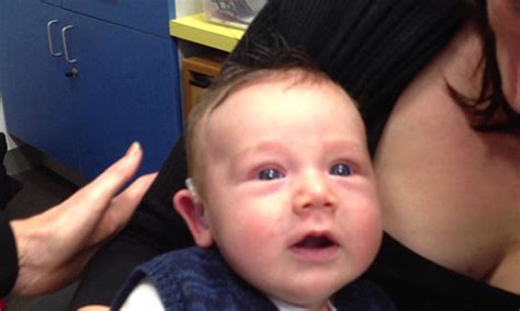 Priceless Reactions Of A Deaf Baby Experiences Hearing For The First Time