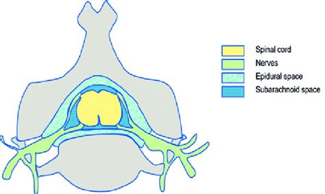 Schematic Overview Of The Epidural And Subarachnoid Space Download