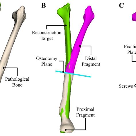 The long bones are those that are longer than they are wide. Long Bone Model Project / Ribs Physiopedia / 3ds max + fbx ...