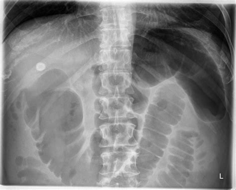 The Xray Doctor Xrayoftheweek 13 Can You Pinpoint The Site Of Pathology