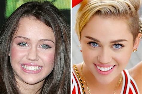 Celebrity Smile Miley Cyrus Dr Monica Crooks Dds