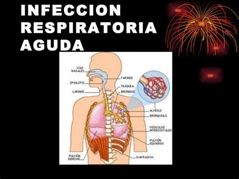 Enfermedad Respiratoria Aguda